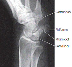Vista anatómica AP oblicua